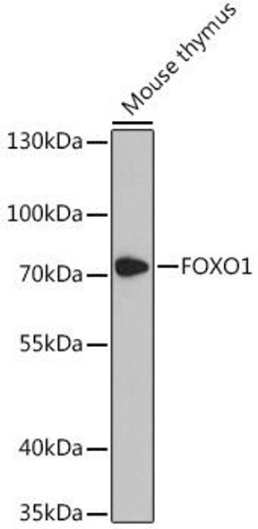 Anti-FOXO1 Antibody (CAB13862)