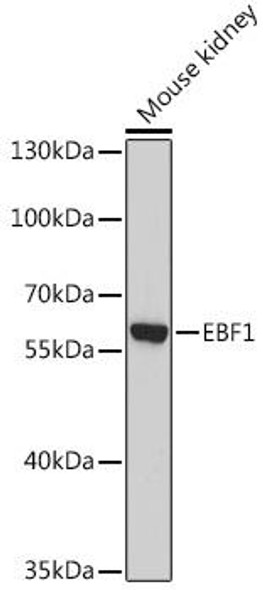 Anti-EBF1 Antibody (CAB13973)