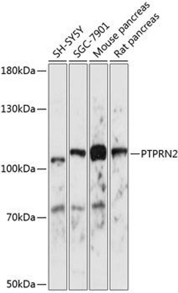 Anti-PTPRN2 Antibody (CAB14774)