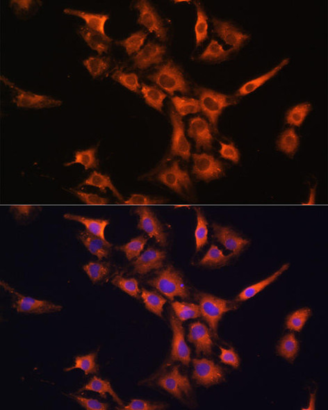 Anti-PFDN5 Antibody (CAB4014)