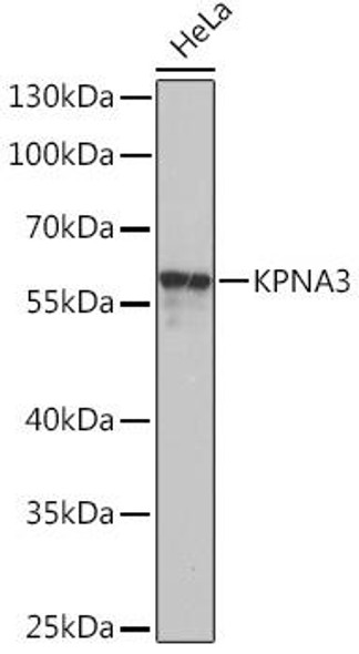 Anti-KPNA3 Antibody (CAB16907)