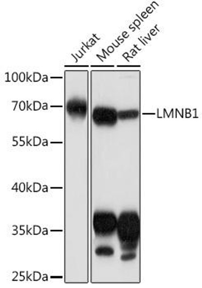 Anti-LMNB1 Antibody (CAB16910)