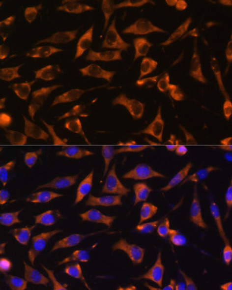 Anti-KANK1 Antibody (CAB17106)