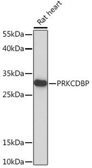 Anti-PRKCDBP Antibody (CAB17247)