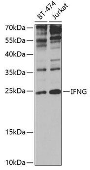 Anti-IFNG Antibody (CAB0242)