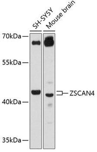 Anti-ZSCAN4 Antibody (CAB12015)