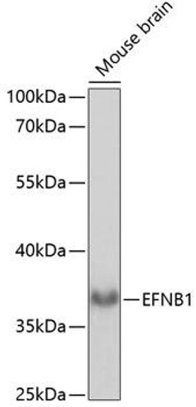 Anti-EFNB1 Antibody (CAB14562)