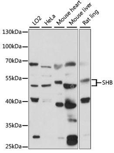 Anti-SHB Antibody (CAB15318)