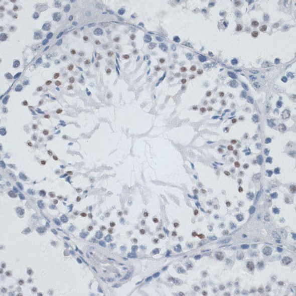 Anti-MSH6 Antibody (CAB16381)