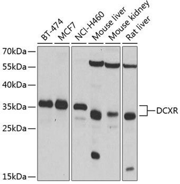 Anti-DCXR Antibody (CAB4721)