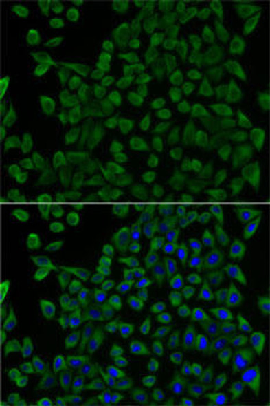 Anti-TCN2 Antibody (CAB5755)