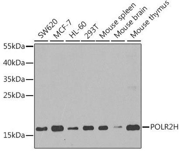 Anti-POLR2H Antibody (CAB6948)