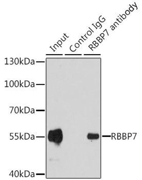 Anti-RBBP7 Antibody (CAB6967)