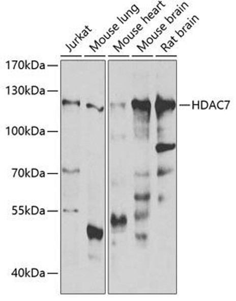 Anti-HDAC7 Antibody (CAB7285)