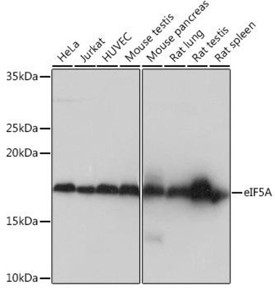 Anti-eIF5A Antibody (CAB4414)