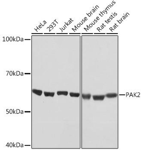 Anti-PAK2 Antibody (CAB4553)