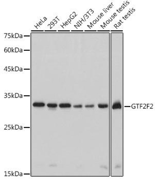 Anti-GTF2F2 Antibody (CAB0536)