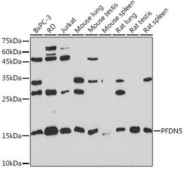 Anti-PFDN5 Antibody (CAB4101)