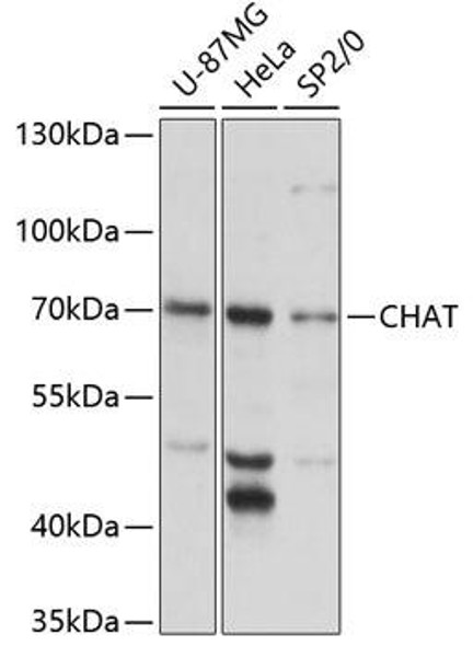 Anti-CHAT Antibody (CAB13244)