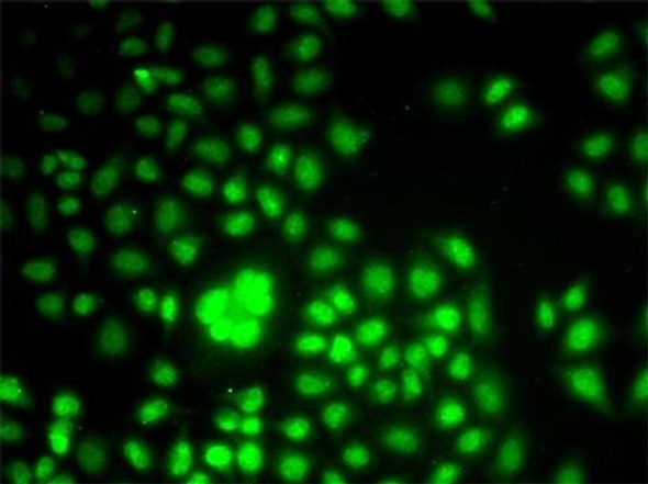 Anti-WDR5 Antibody (CAB13582)