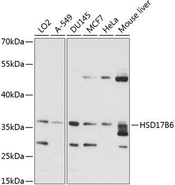 Anti-HSD17B6 Antibody (CAB14474)