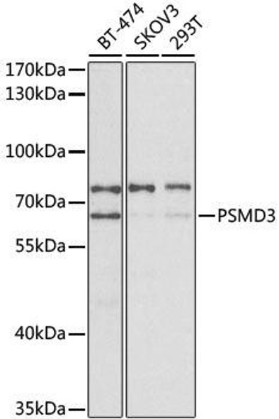 Anti-PSMD3 Antibody (CAB2790)