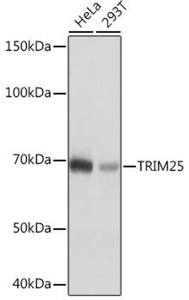 Anti-TRIM25 Antibody (CAB4347)