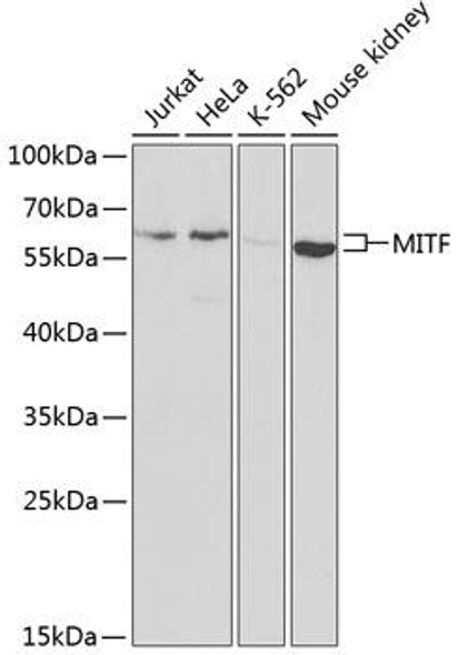 Anti-MITF Antibody (CAB1255)