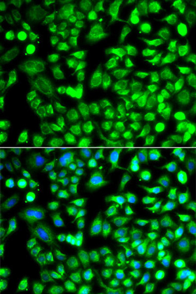 Anti-ALKBH4 Antibody (CAB12593)