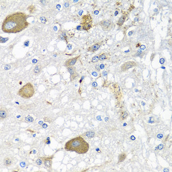 Anti-IFNL3 Antibody (CAB12908)