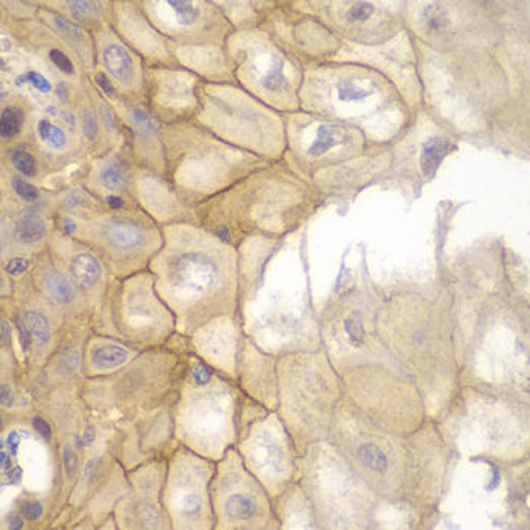 Anti-CD127/IL-7R Antibody (CAB13503)