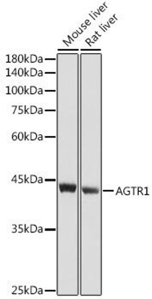 Anti-AGTR1 Antibody (CAB14201)