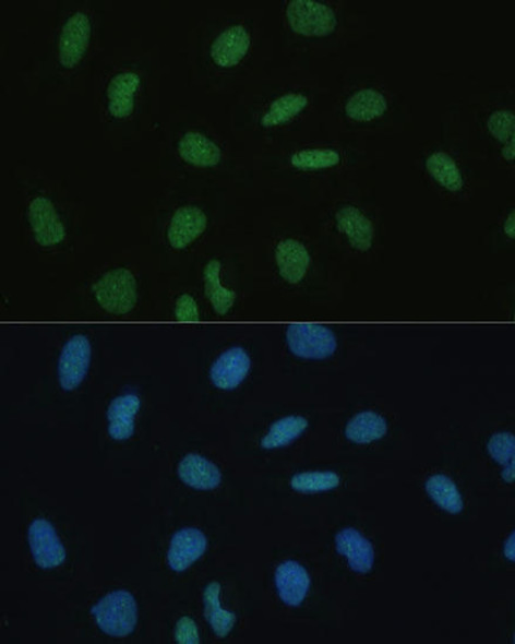 Anti-MKL1 Antibody (CAB14212)