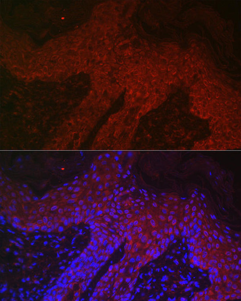 Anti-DKK2 Antibody (CAB14874)