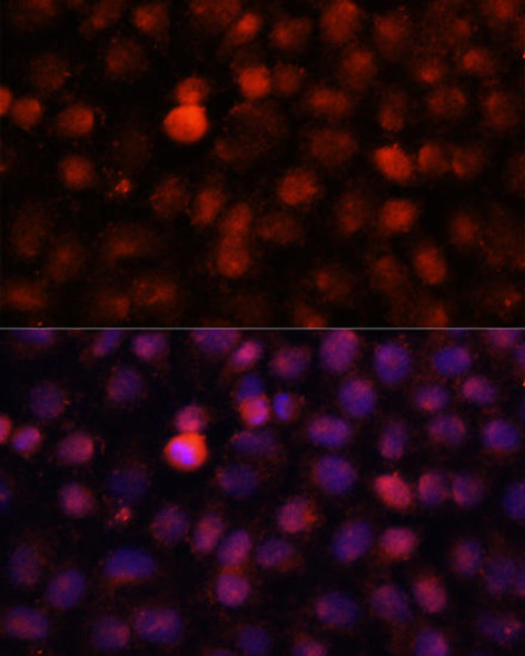 Anti-N4-Methylcytidine Antibody (CAB15989)