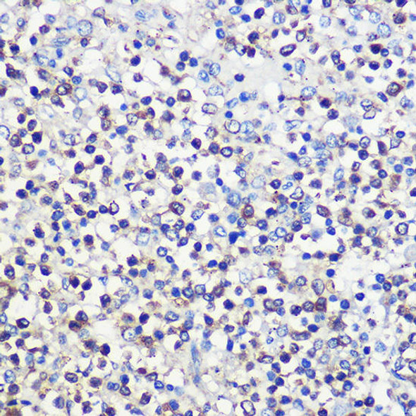 Anti-CD80 Antibody (CAB16039)