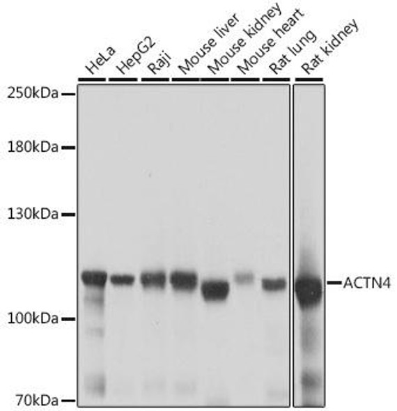 Anti-ACTN4 Antibody (CAB16310)