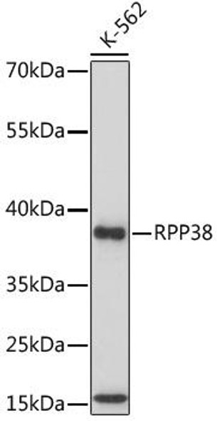 Anti-RPP38 Antibody (CAB17080)
