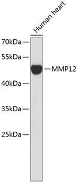 Anti-MMP12 Antibody (CAB1709)