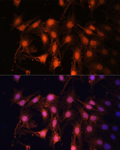 Anti-E2F1 Antibody (CAB2067)