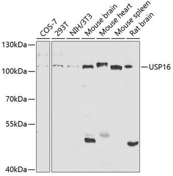 Anti-USP16 Antibody (CAB5861)