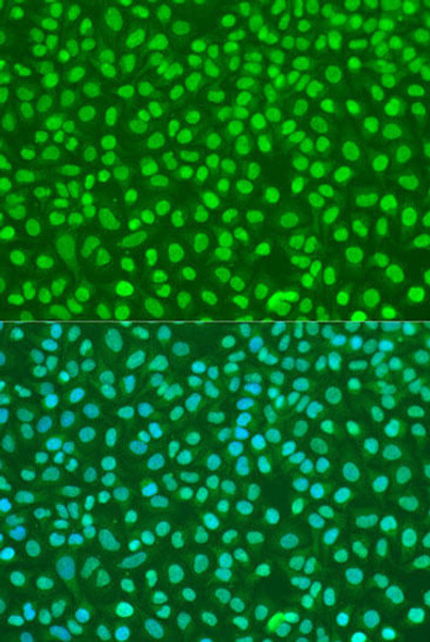 Anti-NBN Antibody (CAB7703)