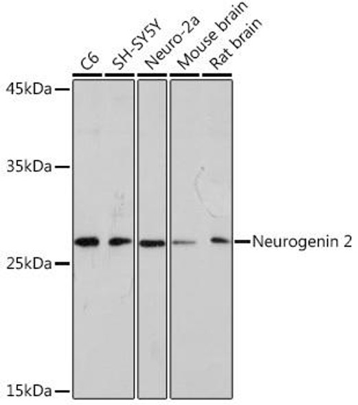 Anti-Neurogenin 2 Antibody (CAB19800)