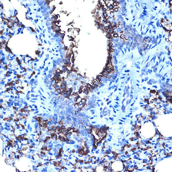 Anti-MUC1 Antibody (CAB0333)