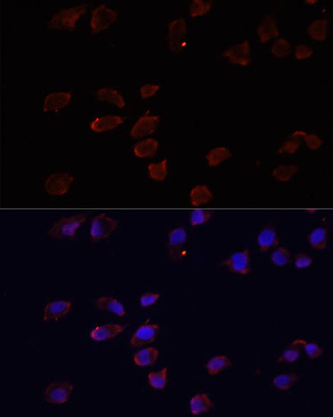 Anti-ARF6 Antibody (CAB0988)