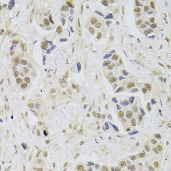 Anti-UBE3C Antibody (CAB6442)