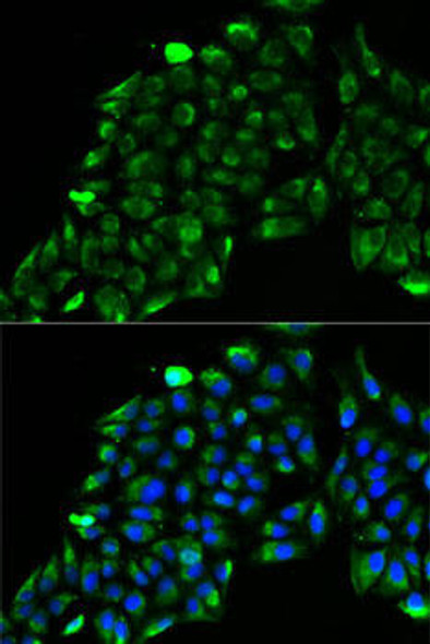 Anti-ACADS Antibody (CAB7230)