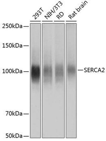 Anti-SERCA2 Antibody (CAB11692)