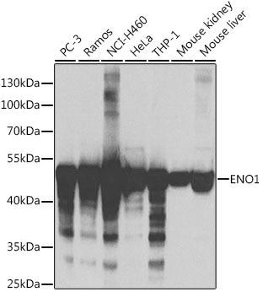 Anti-ENO1 Antibody (CAB1033)[KO Validated]