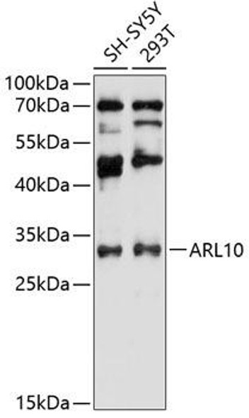 Anti-ARL10 Antibody (CAB12800)